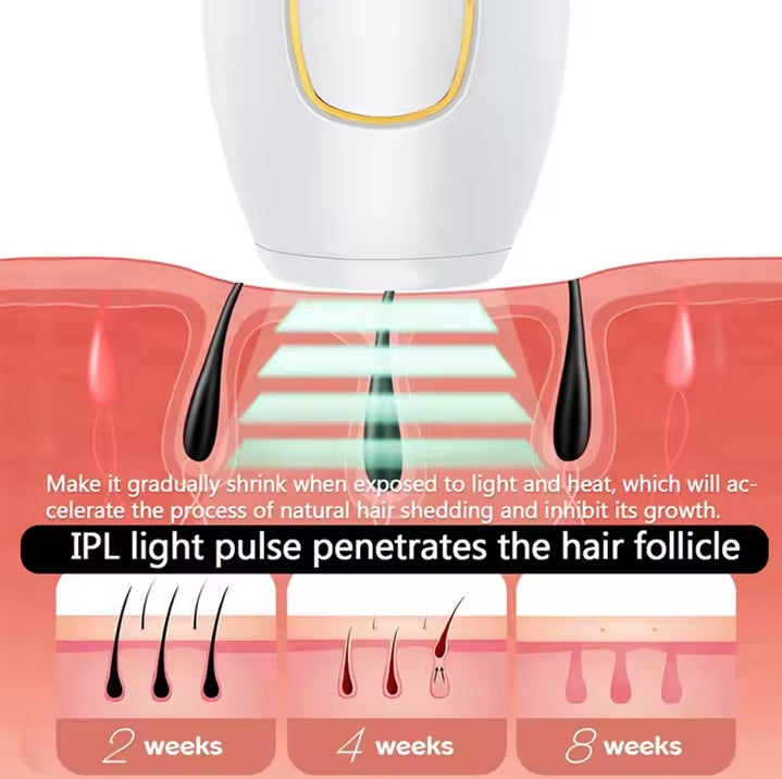 Epilateur Laser Removal Hair™