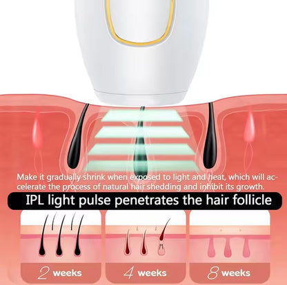 Epilateur Laser Removal Hair™
